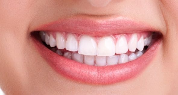 Invisalign consultation